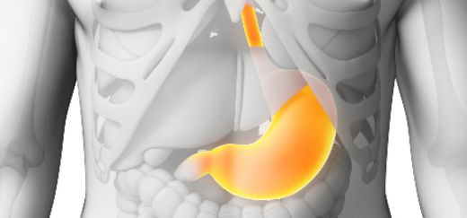 Antral Ülser Belirtileri ve Tedavisi